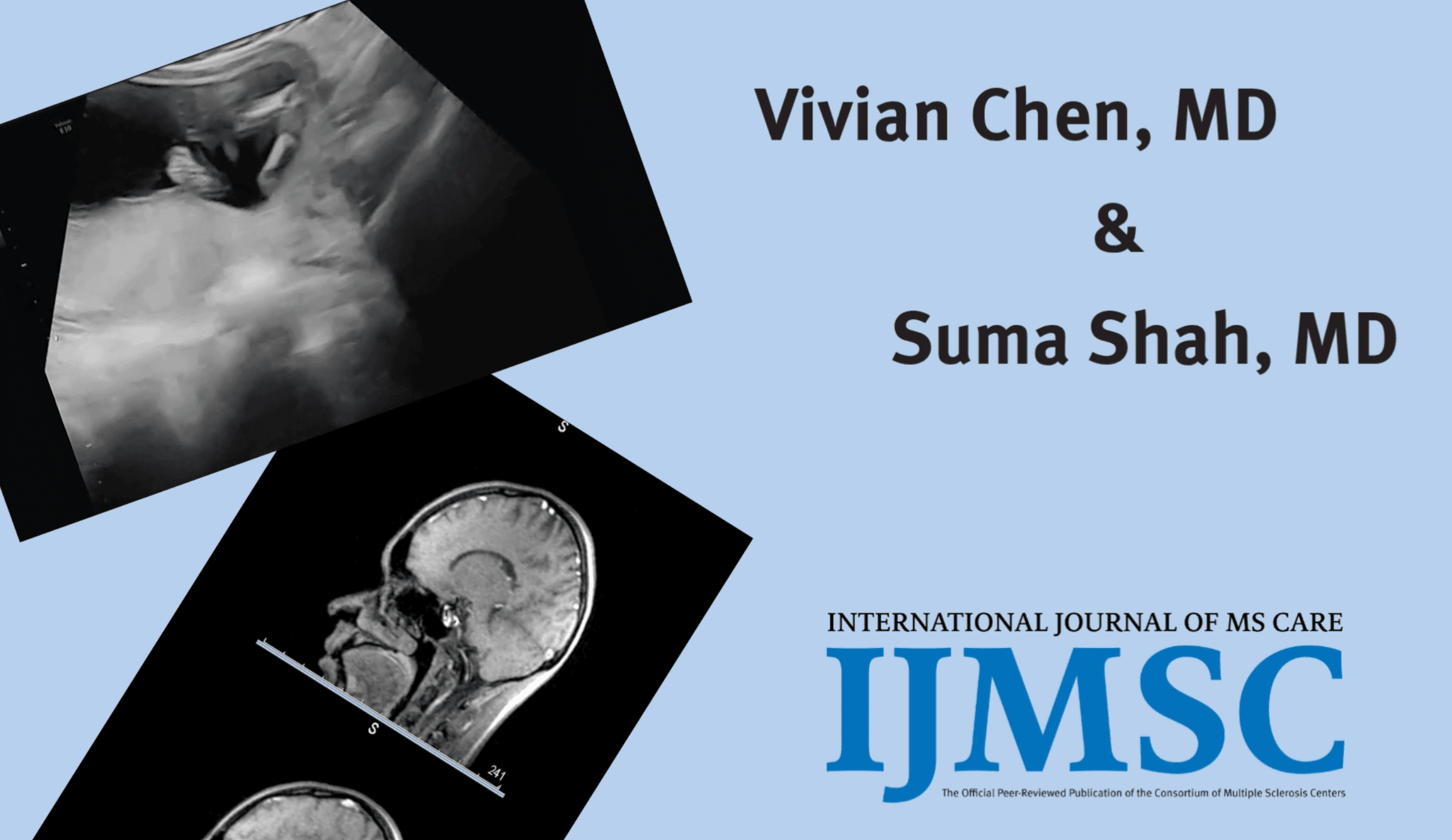 IJMSC Author Spotlight: Vivian Chen, MD, and Suma Shah, MD